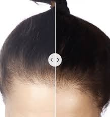 Natural Hair Regrowth Shampoo (DHT Blocker)